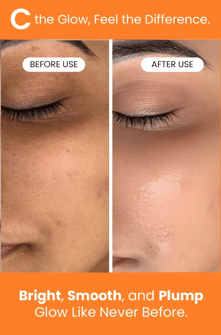 C-Glow Vitamin C Serum - Image 6